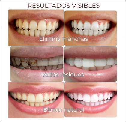 Crema Dental Blanqueadora 2x1